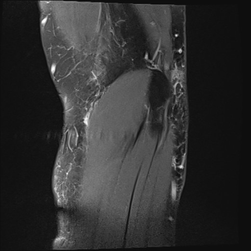 Click on the Serie image to view the images of Wieszt, Gnter